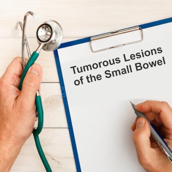 Small bowel tumors are relatively rare. They can be classified as epithelial, mesenchymal, lymphoproliferative, or metastatic tumors...